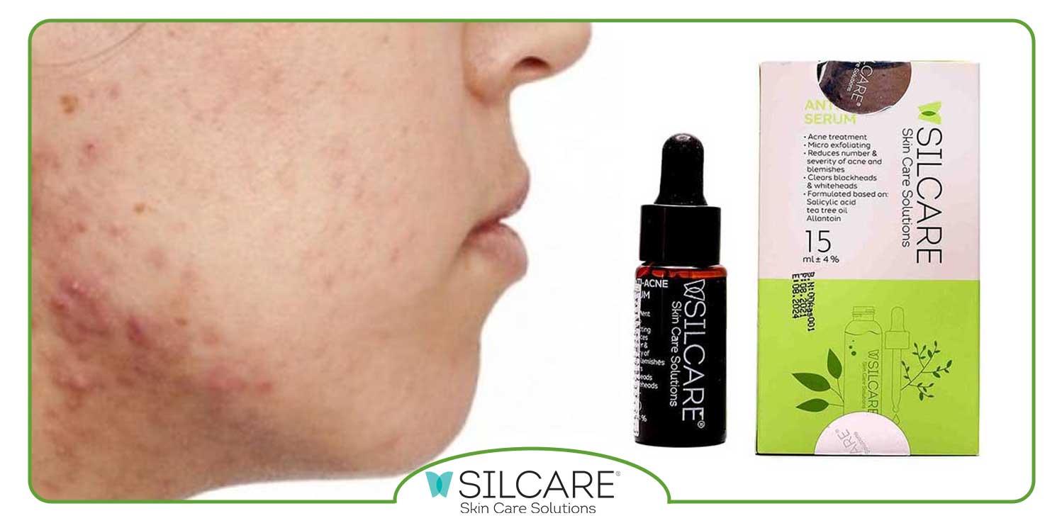 بهترین سرم برطرف کننده آکنه