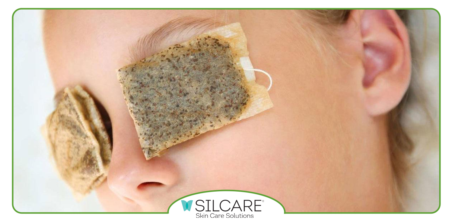 از بین بردن پف زیر چشم فوری خانگی