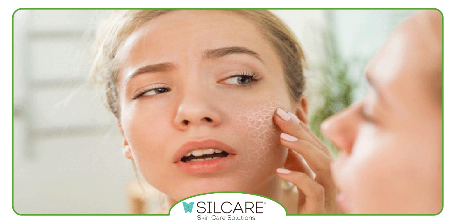 انواع کرم مرطوب کننده قوی برای پوست های خیلی خشک کدامند؟