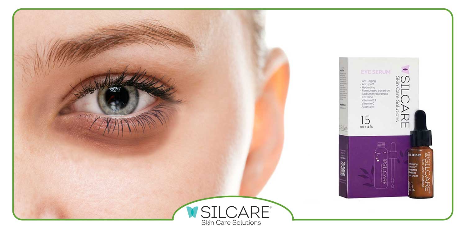 چگونه پف زیر چشم را برای همیشه از بین ببریم؟