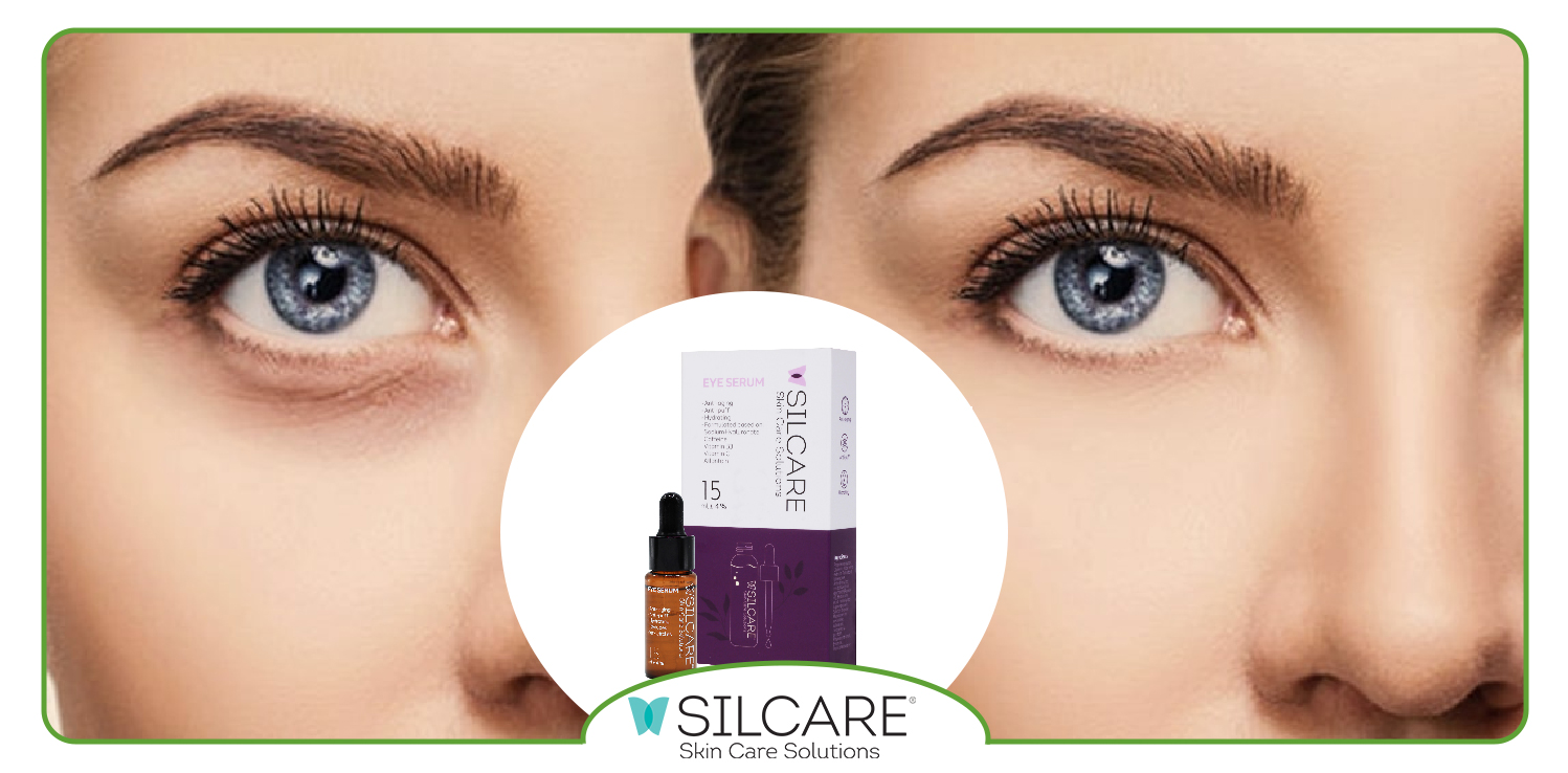 بهترین سرم دور چشم برای رفع تیرگی