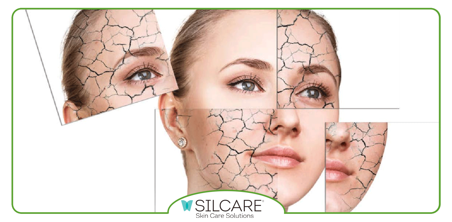 بهترین محصولات برند سیلکر