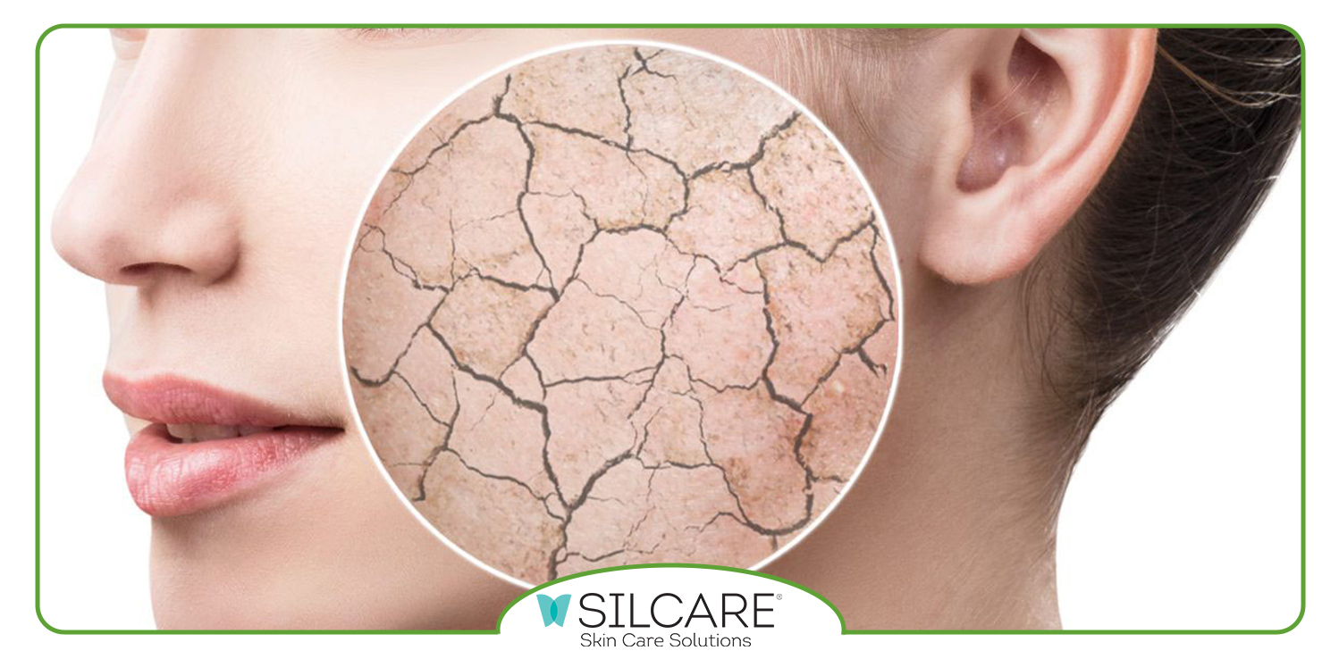 بهترین کرم برای پوست خشک و حساس