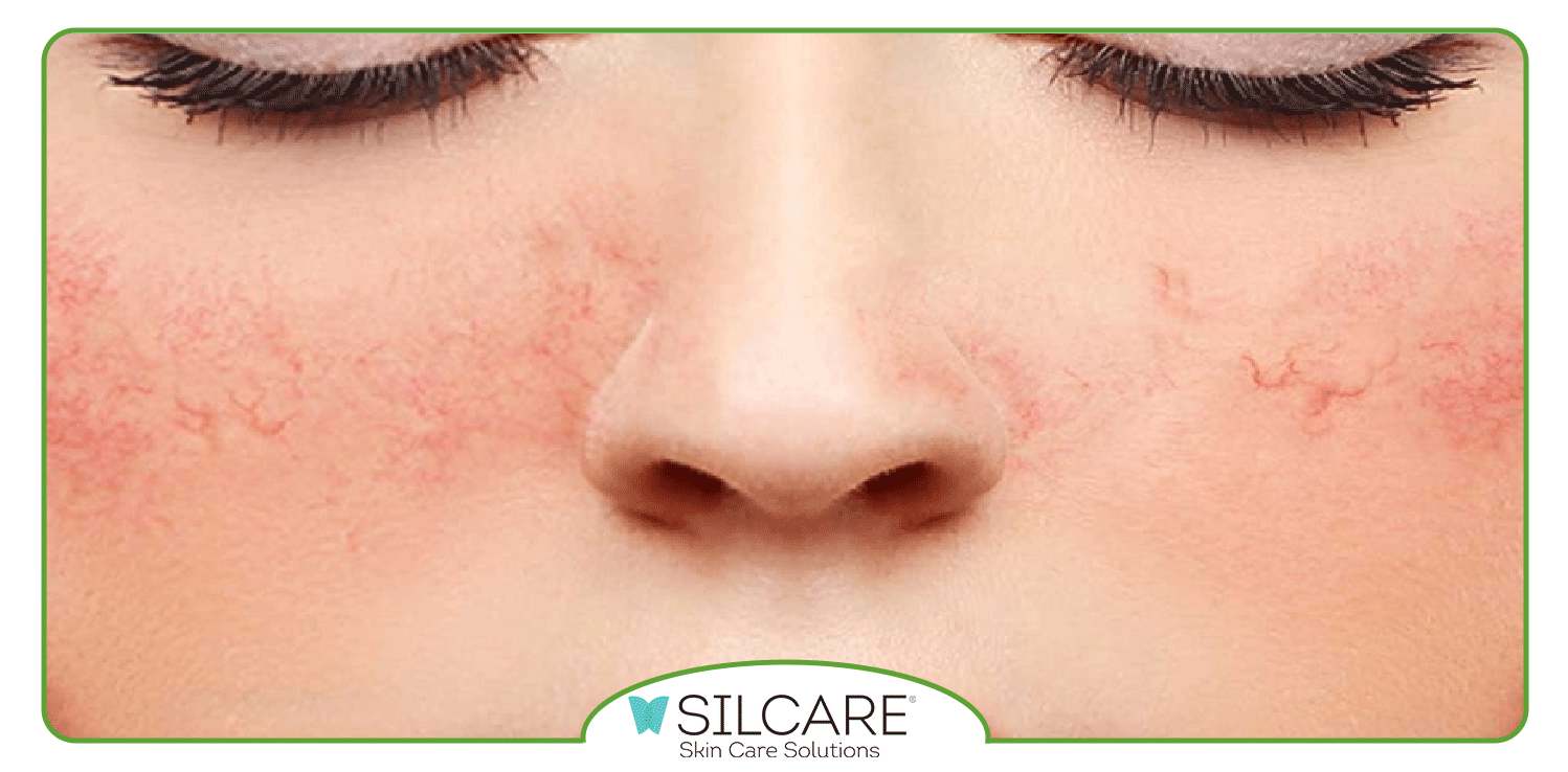 بهترین کرم های ترمیم کننده صورت کدامند؟