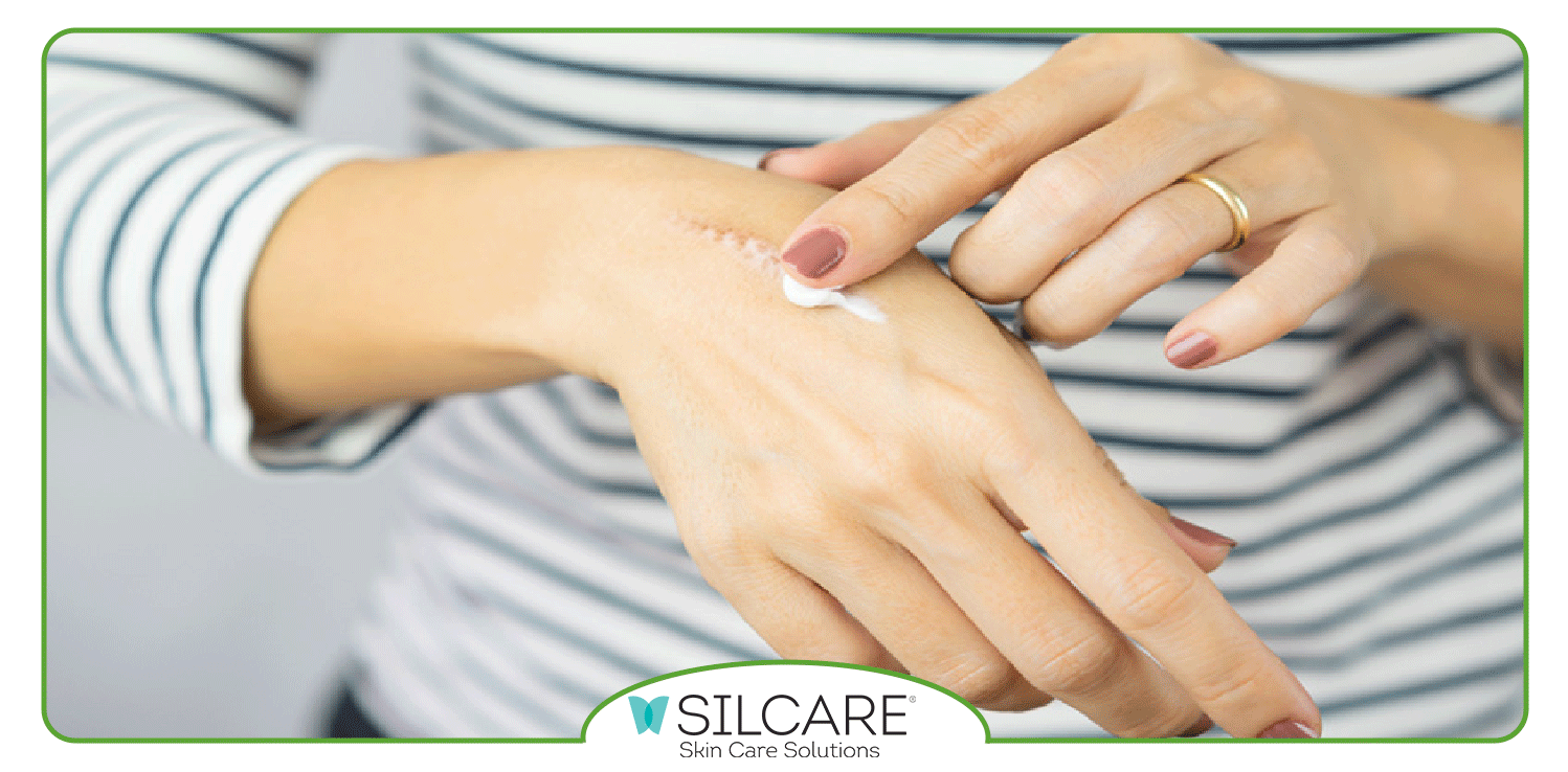 ترکیبات موجود در کرم ترمیم کننده جای بخیه