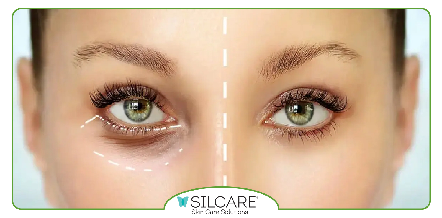 خواص سرم دور چشم