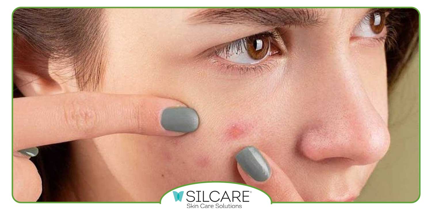 دلایل به وجود آمدن جوش های پوستی