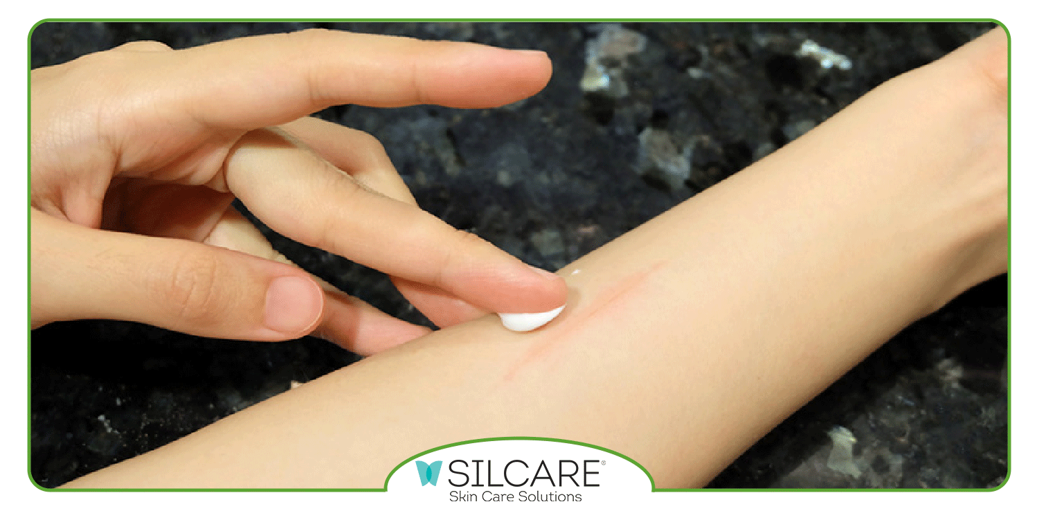 دلایل استفاده از کرم ترمیم کننده جای بخیه