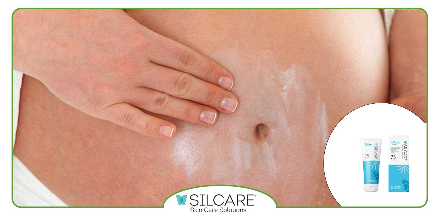 بهترین پماد برای اگزمای پوستی در دوران بارداری