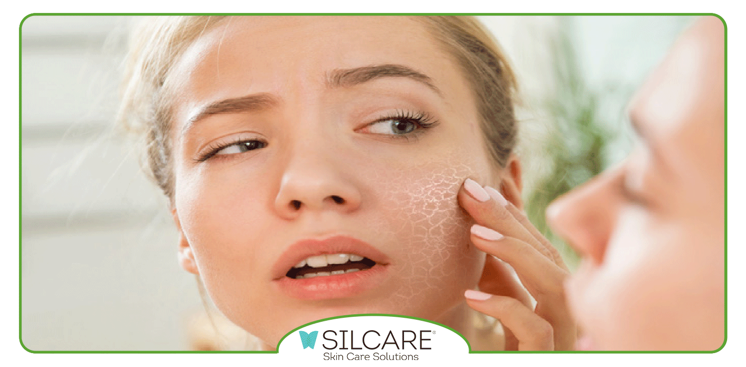 کرم مرطوب کننده قوی برای پوست دست خیلی خشک باید چه ویژگی هایی داشته باشد؟