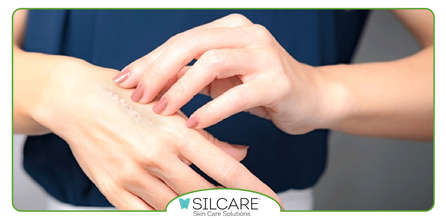 انواع کرم ترمیم کننده جای بخیه کدامند؟