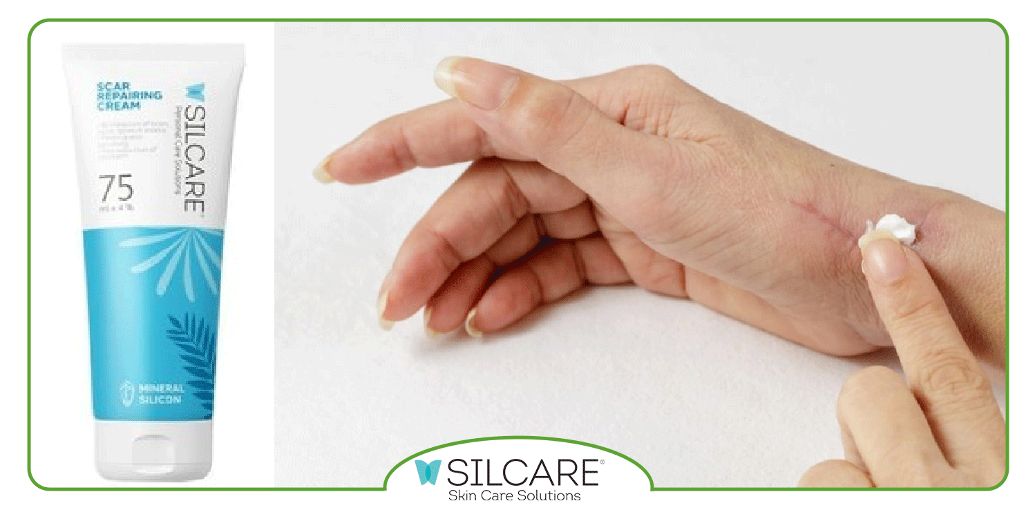 انواع کرم ترمیم کننده جای بخیه