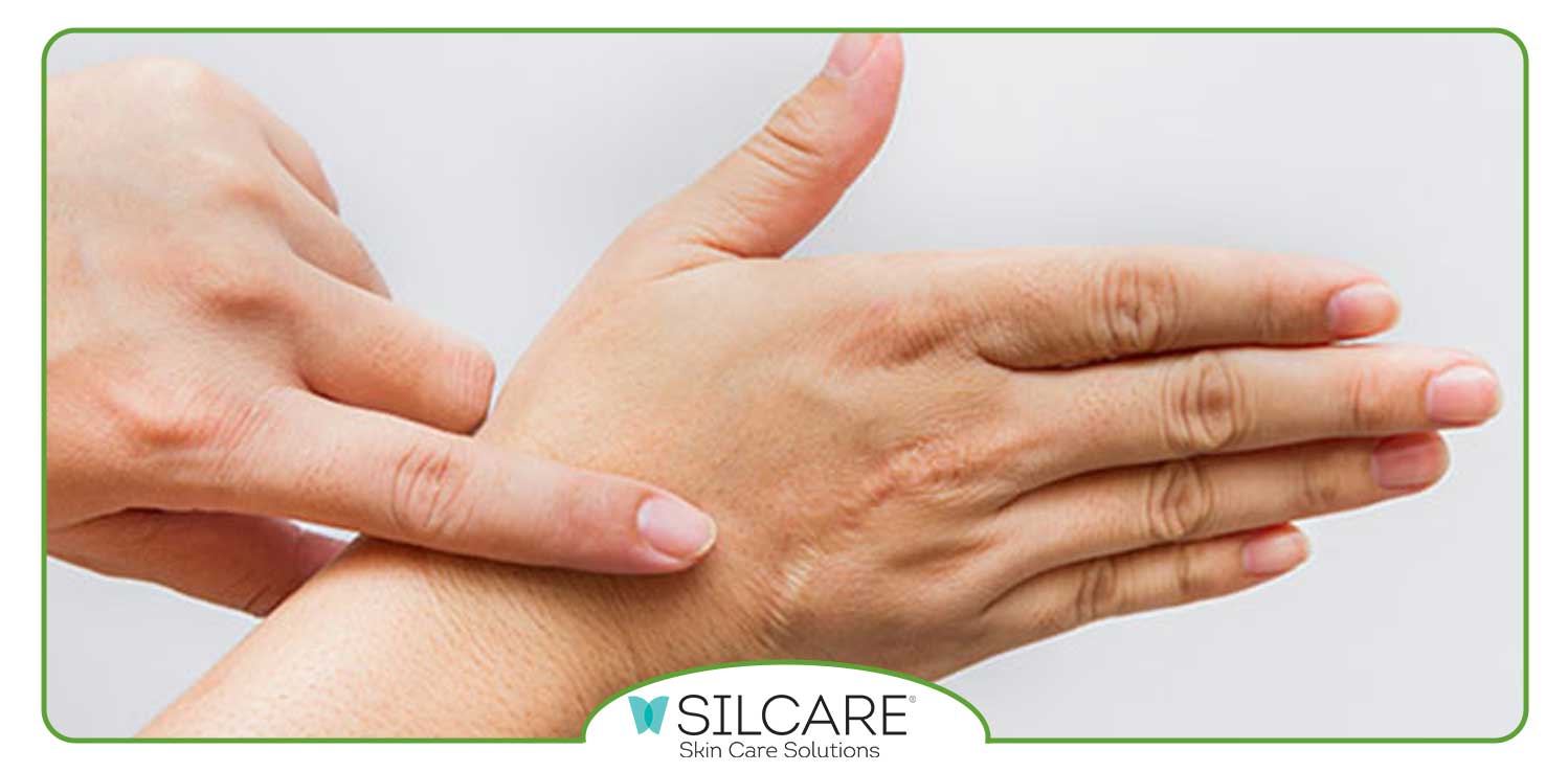 تاثیر استفاده از کرم ترمیم کننده برای جای بخیه و زخم