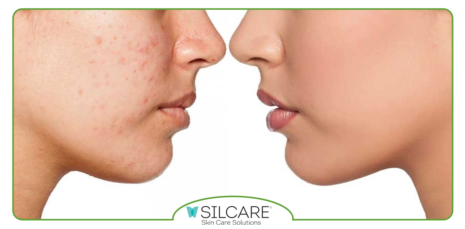 بهترین سرم روشن کننده پوست ایرانی