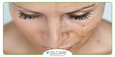 بهترین سرم ضد لک ایرانی