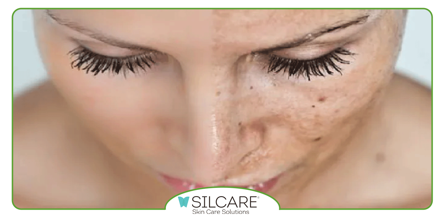 بهترین سرم ضد لک ایرانی