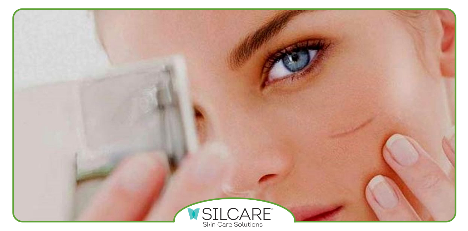 بهترین پماد برای ازبین بردن جای زخم قدیمی