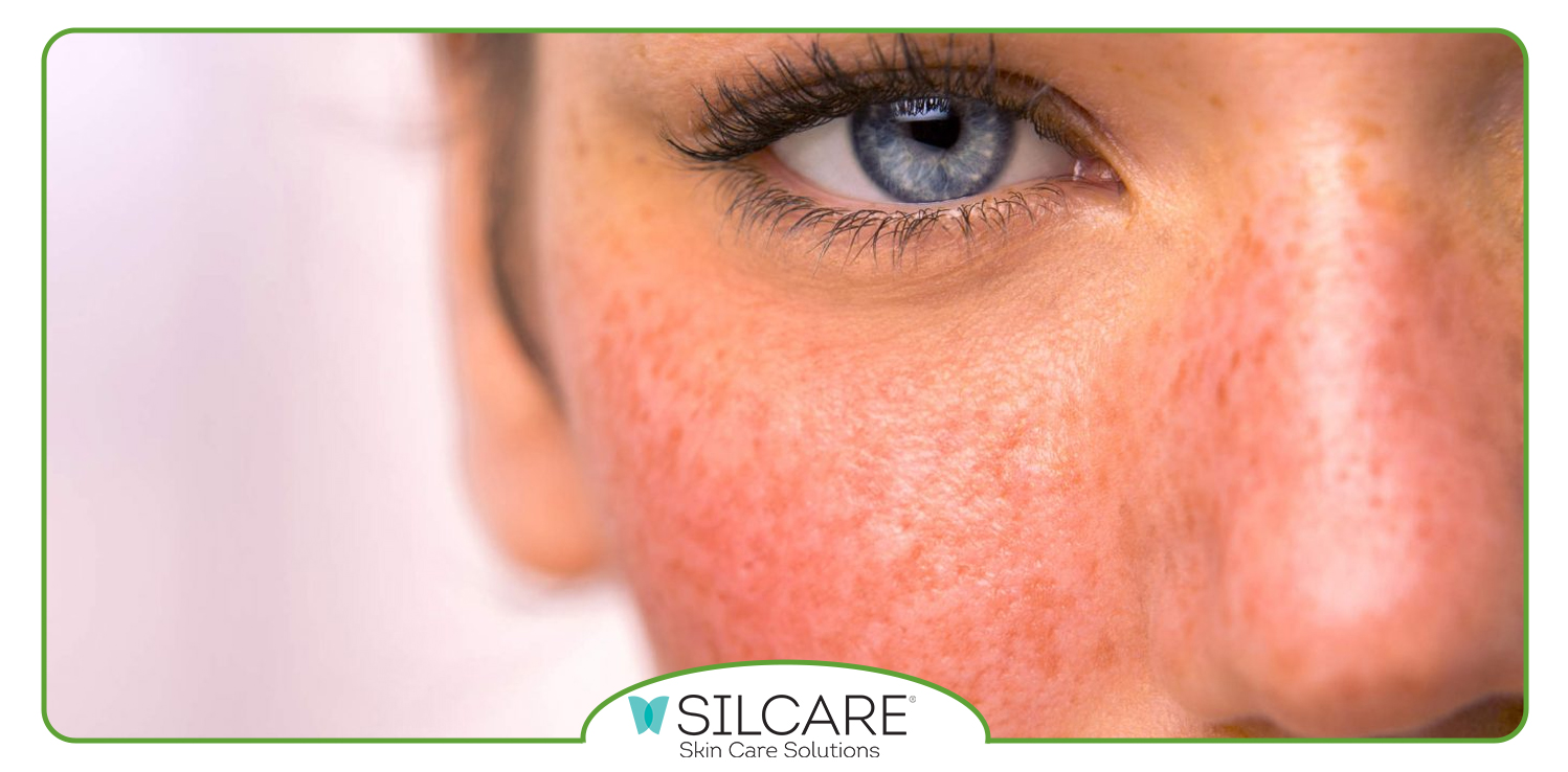 بهترین کرم آبرسان و روشن کننده پوست