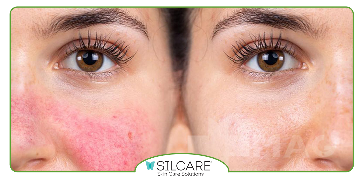 بهترین کرم مرطوب کننده ایرانی