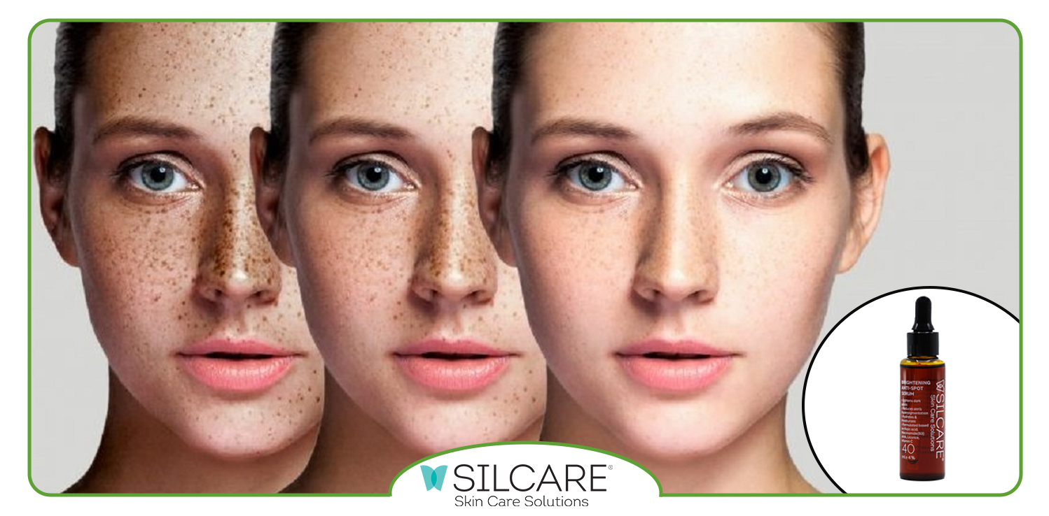 خرید سرم ضد لک ایرانی سیلکر