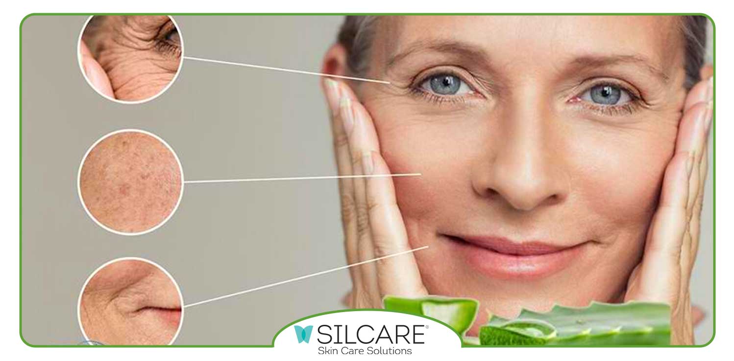 خواص ژل آلوئه ورا برای پوست