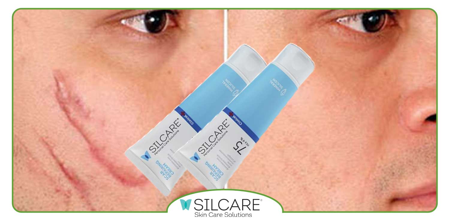 بهترین کرم ترمیم کننده کدام است؟