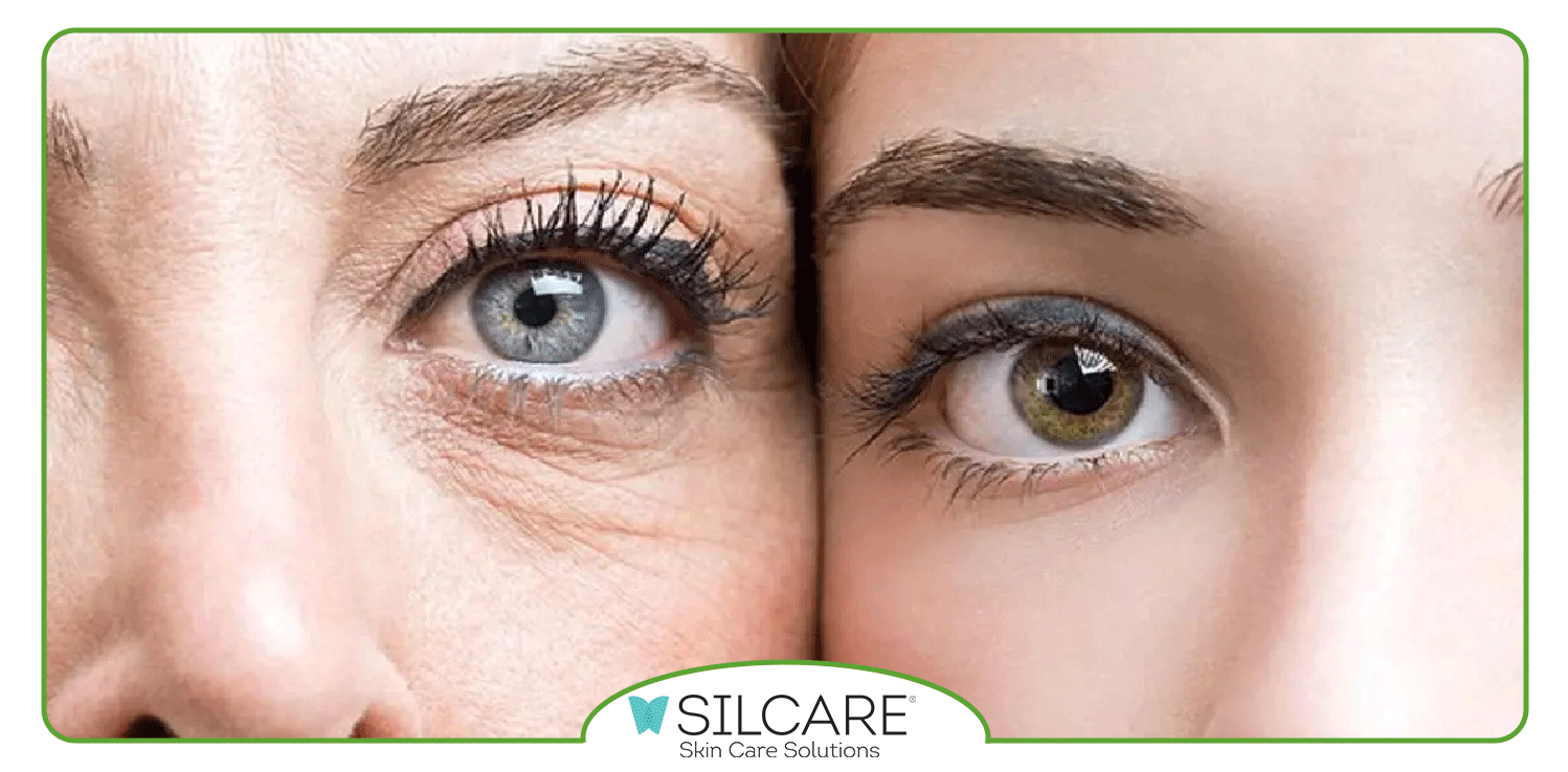 سرم دور چشم خوب چی بخریم؟