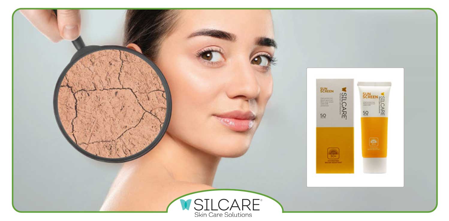 ضدآفتاب سیلکر