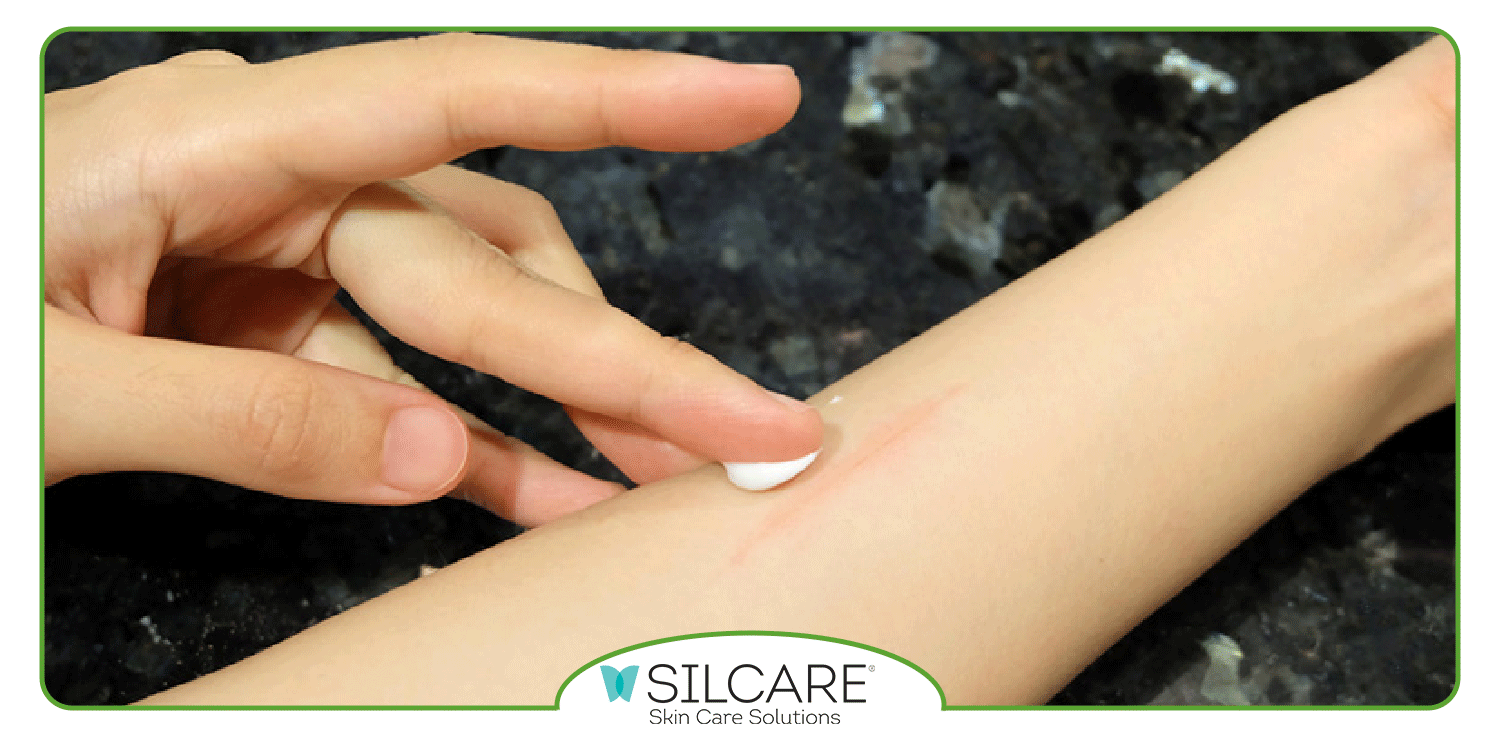 نحوه مصرف کرم ترمیم کننده جای بخیه سیلکر