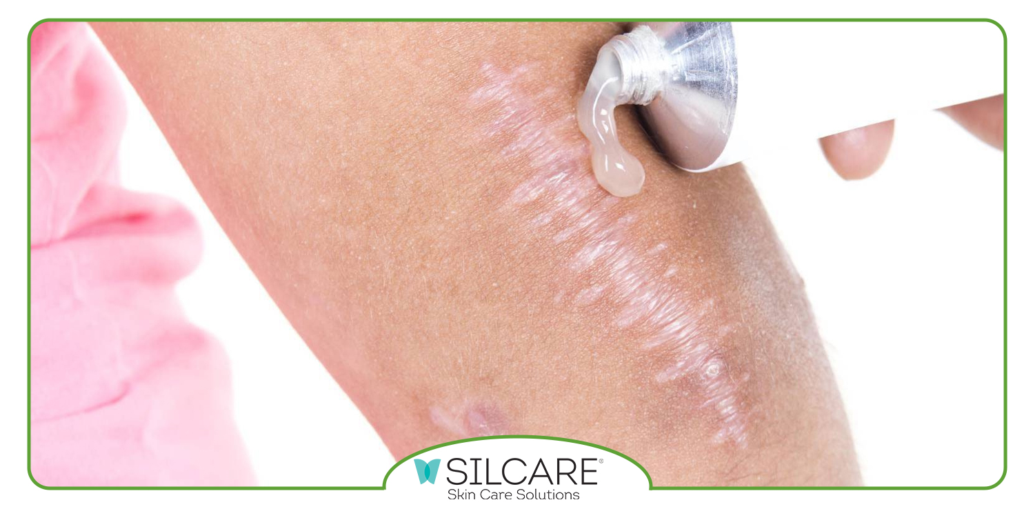 پماد ترمیم کننده جای بخیه