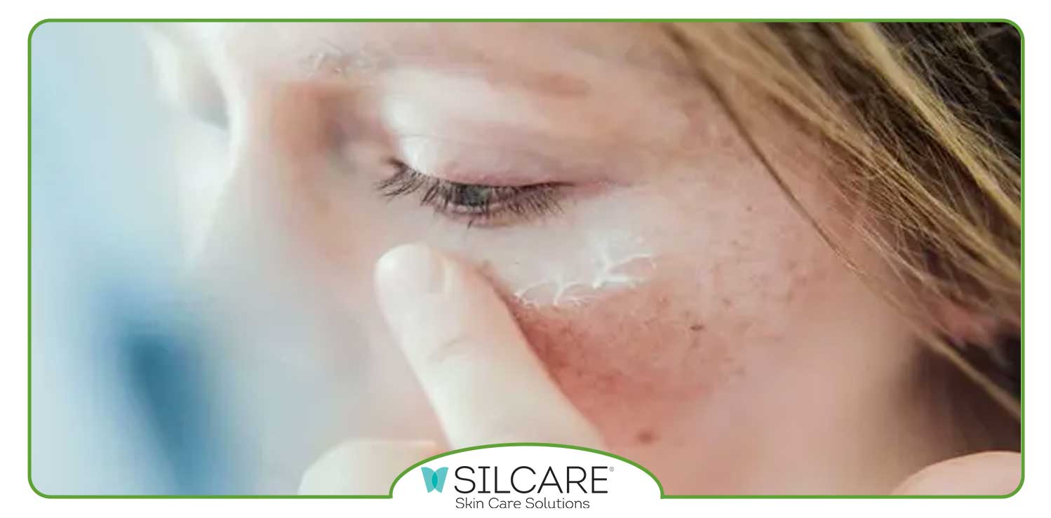 چرا باید از ضد آفتاب استفاده کنیم؟