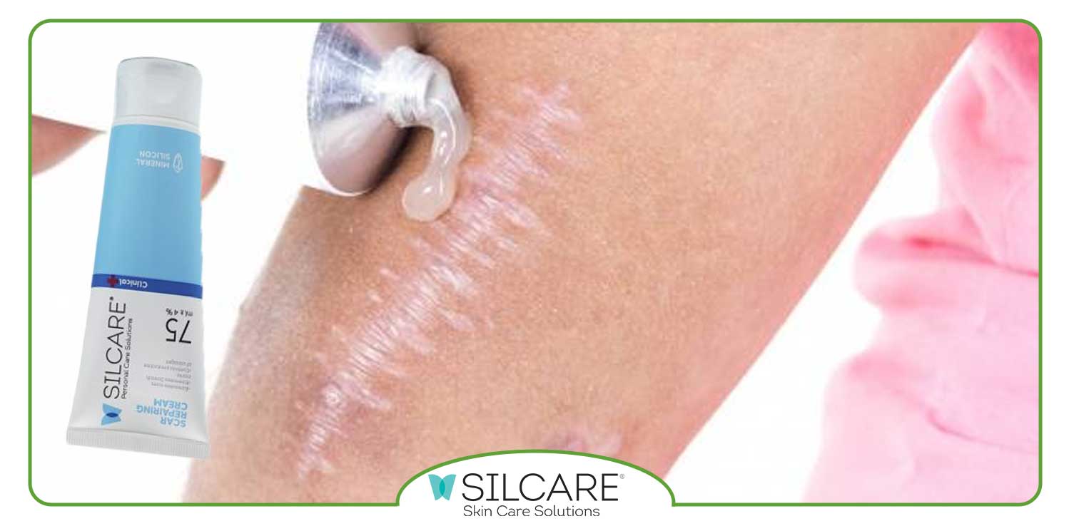 کرم ترمیم کننده سیلکر