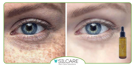 بهترین سرم ضد لک قوی