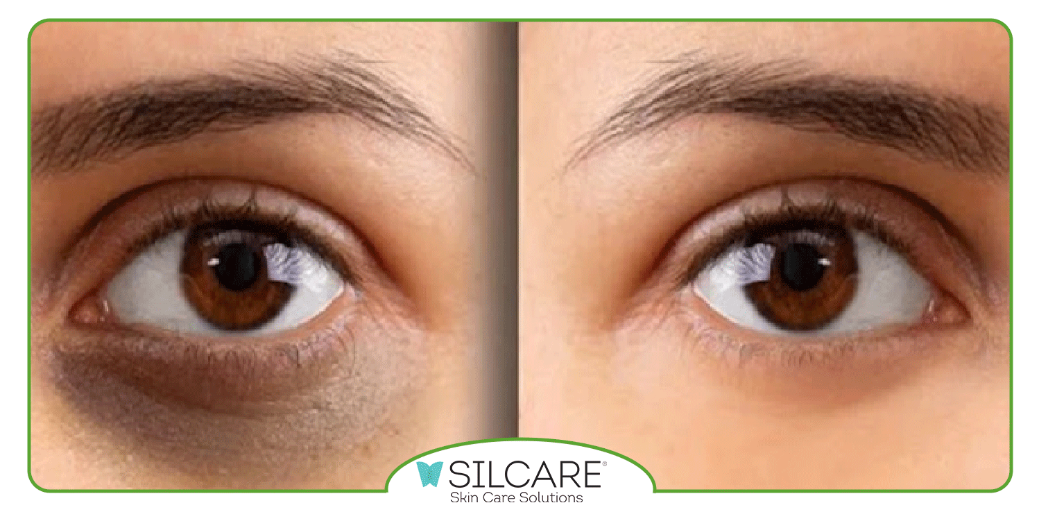 خواص سرم دور چشم