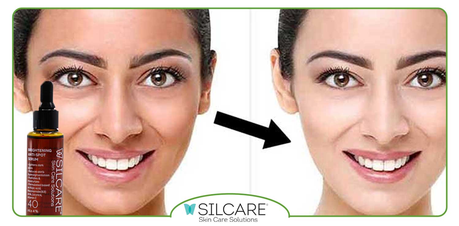 ویژگی های سرم ضد لک و روشن کننده سیلکر