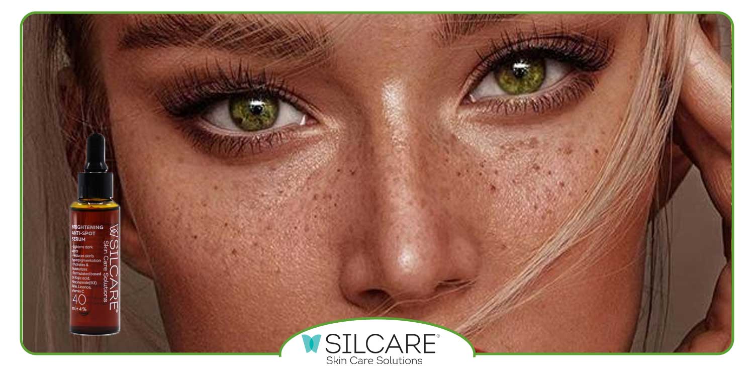 بهترین سرم برای از بین بردن کک و مک صورت