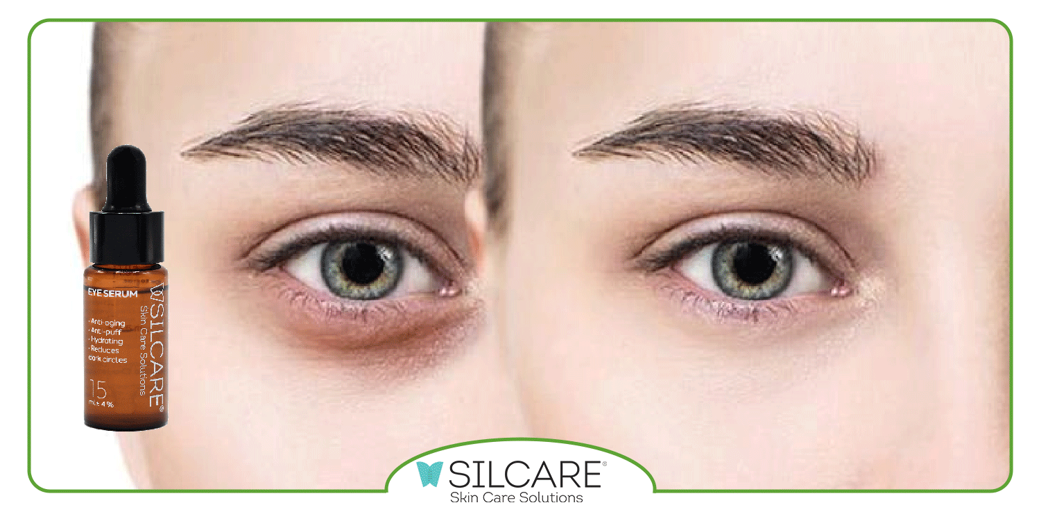 سرم دور چشم چه ترکیباتی دارد؟