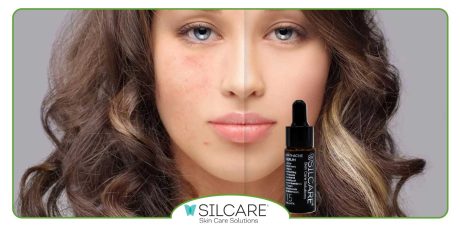 بهترین سرم درمان جوش فوری