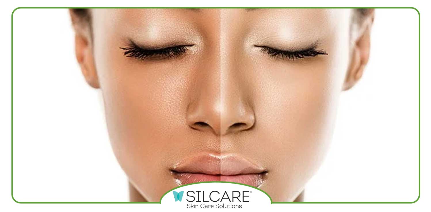 یک سرم روشن کننده باید چه ترکیباتی داشته باشد؟