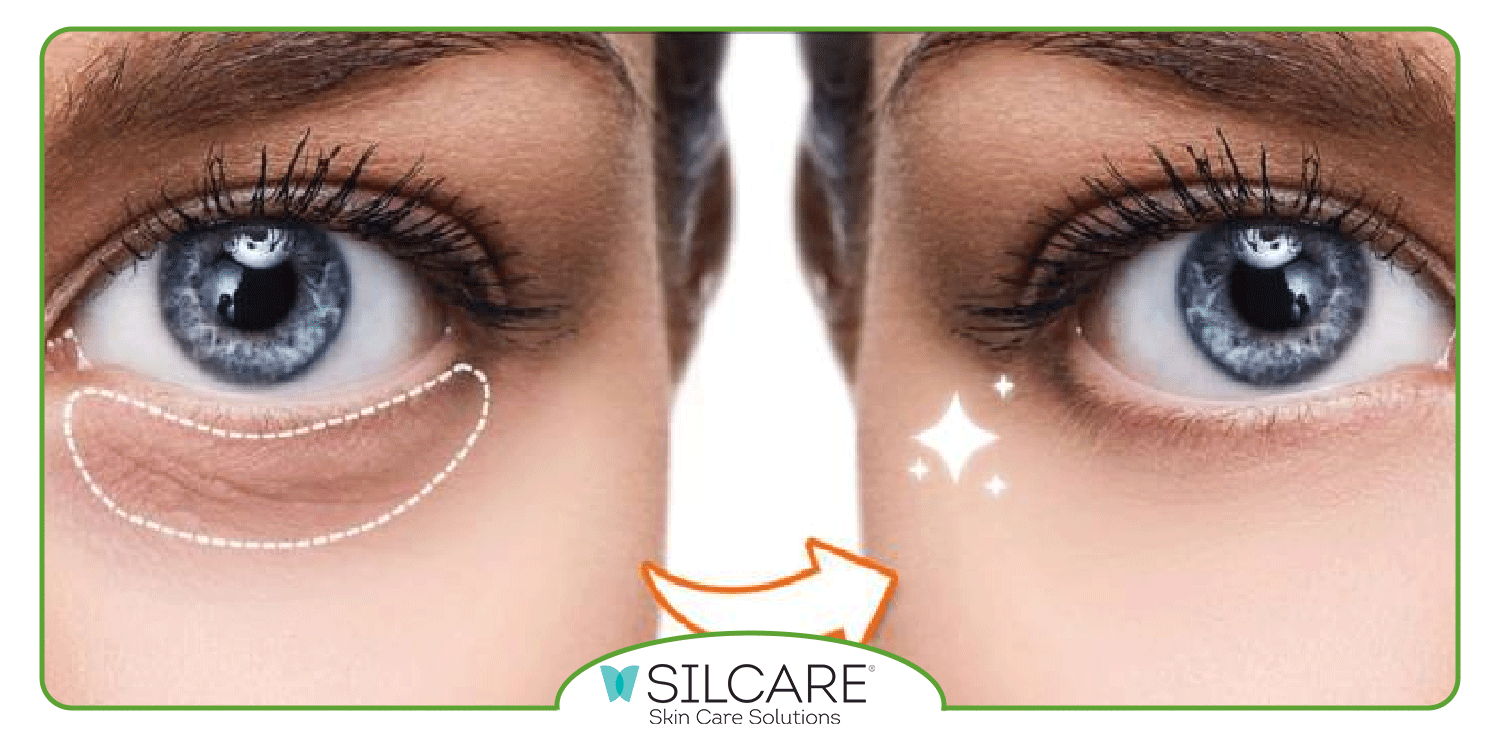 طریقه مصرف سرم دور چشم سیلکر به چه صورت است؟