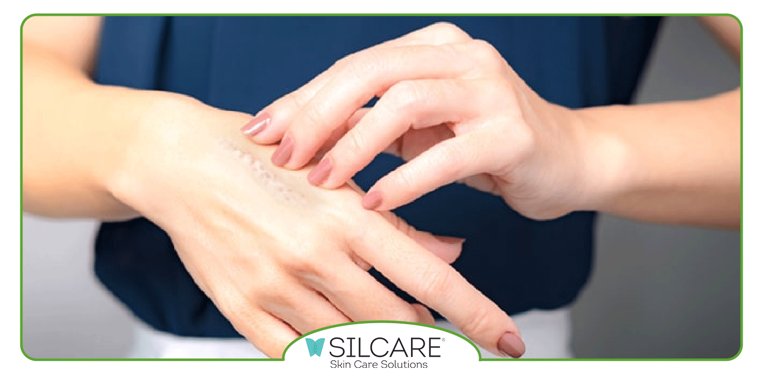 مزایای استفاده کرم ترمیم کننده سیلکر