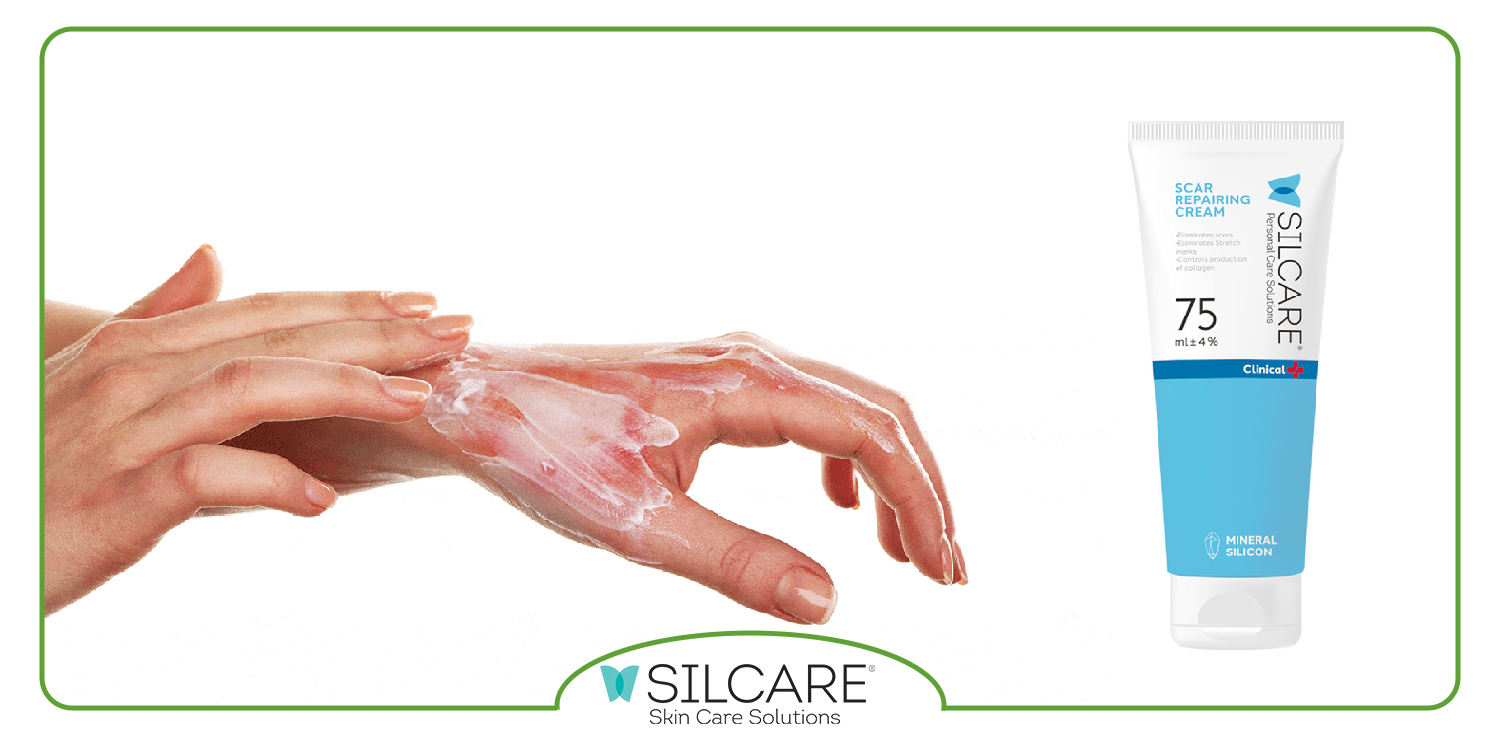 مقایسه کرم ترمیم کننده سیلکر با سایر برند ها