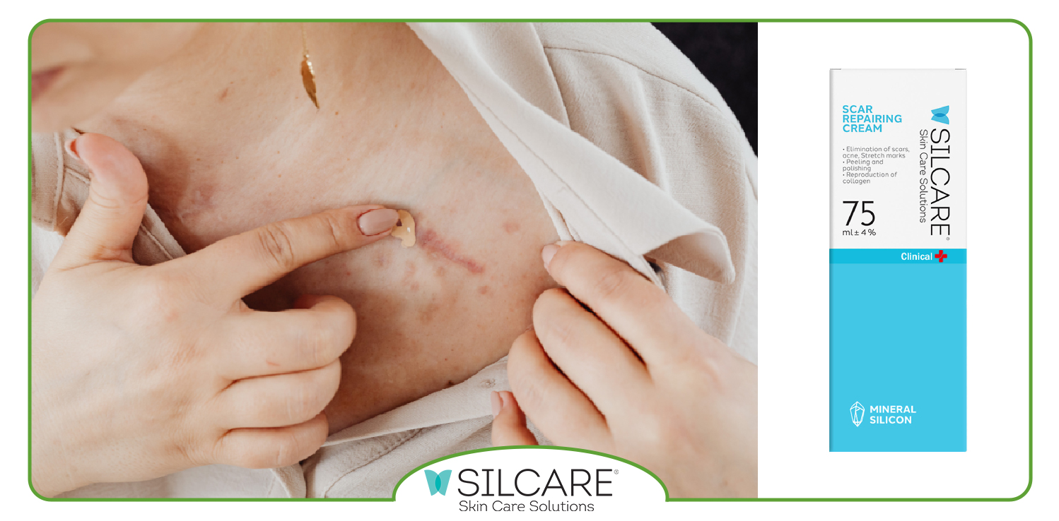 نحوه استفاده از کرم ترمیم کننده جای زخم