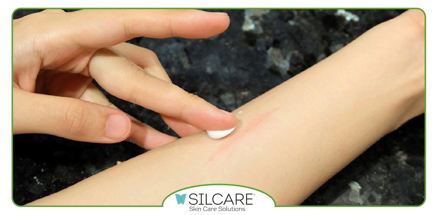 نحوه استفاده از کرم ترمیم کننده جای زخم