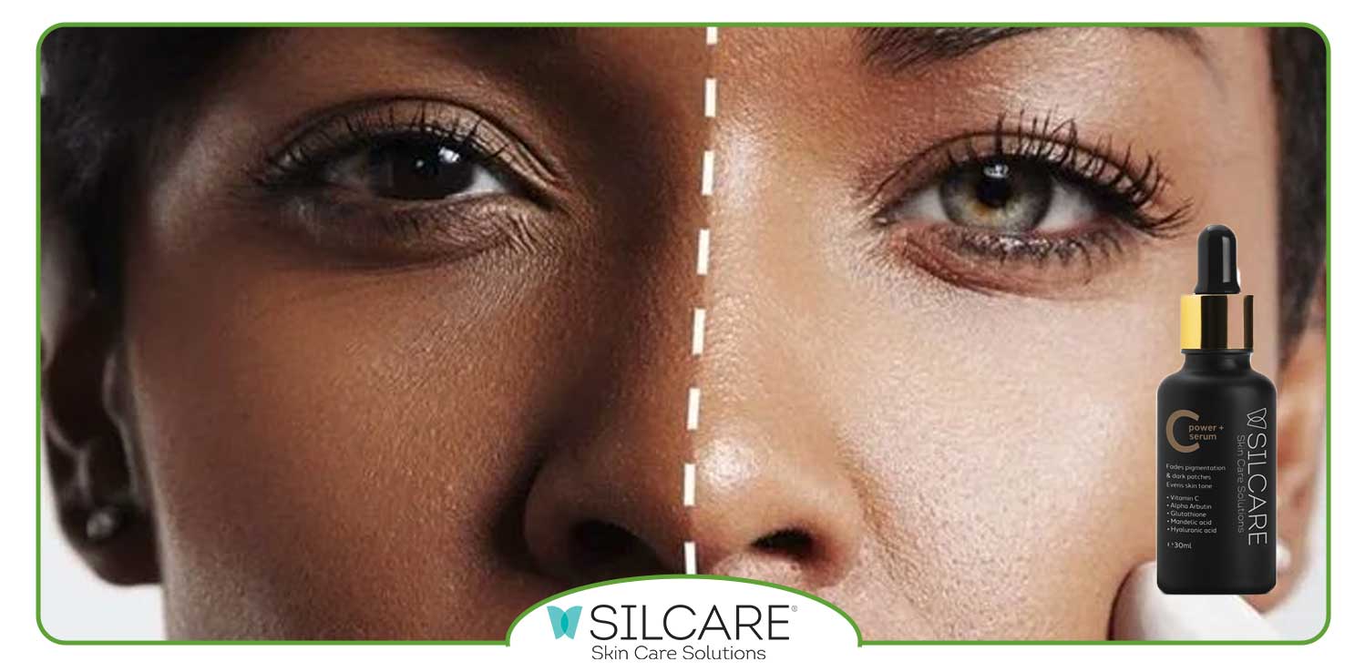 ویژگی های سرم ویتامین سی (C) سیلکر