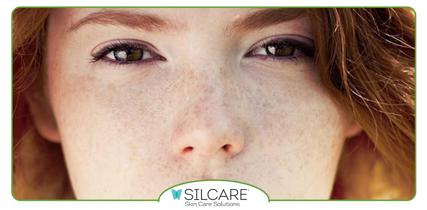 کک و مک چیست؟