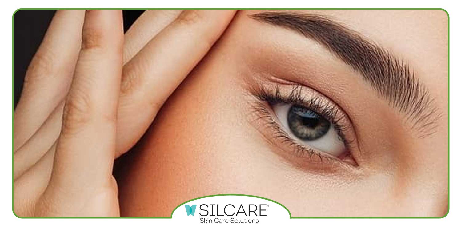 خشکی دور چشم درمان