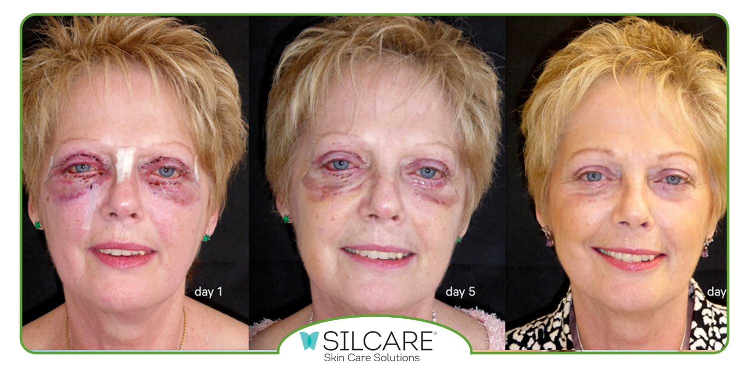 خرید کرم ترمیم کننده جای زخم