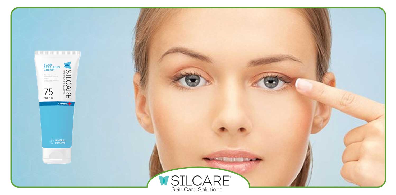 بهترین کرم ترمیم کننده زخم بلفاروپلاستی