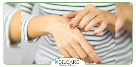 بهترین زمان استفاده از کرم ترمیم کننده جای بخیه